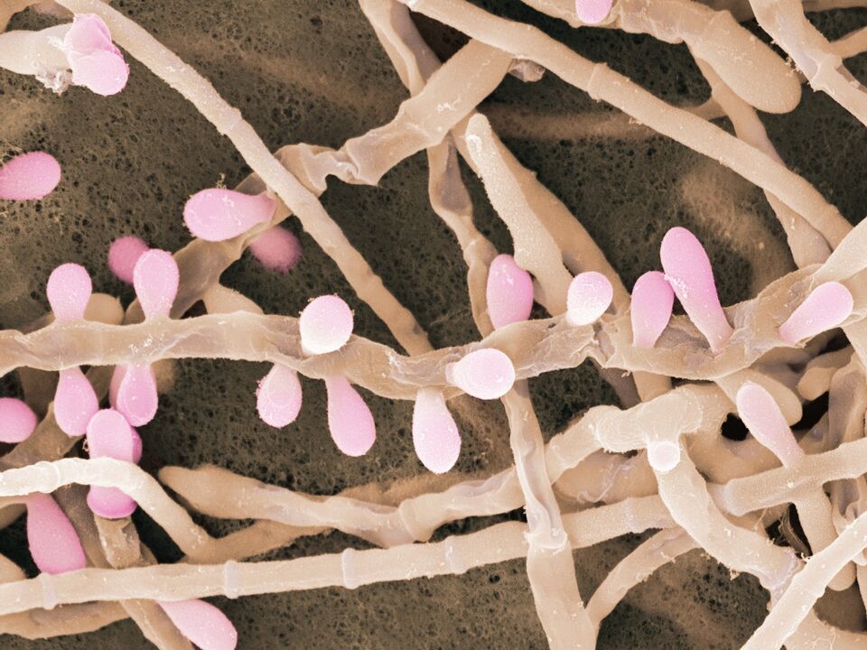 Trichophyton rubrum je vrsta glive, ki prizadene kožo stopal.